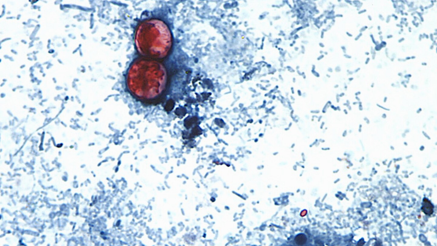 Officials Declare an End to the Record-Setting Cyclospora Outbreak